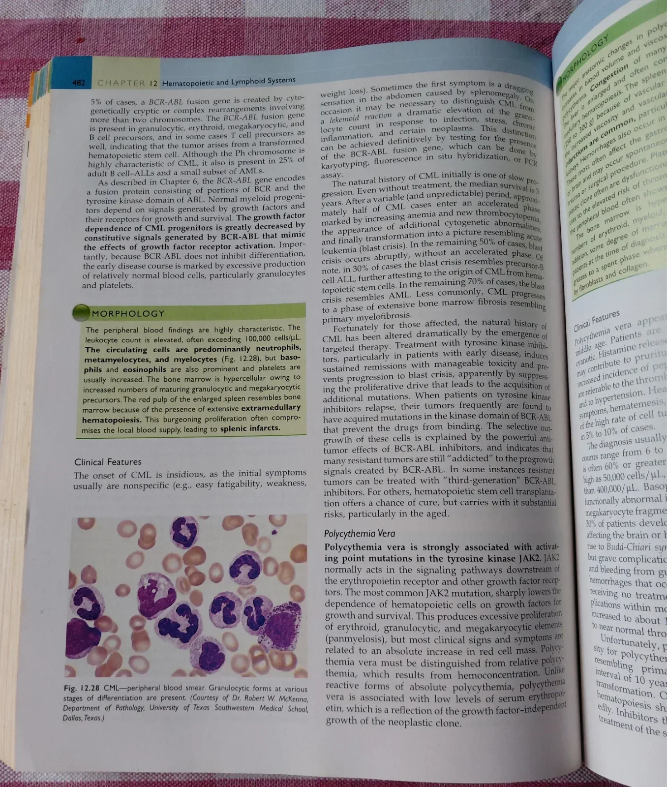 Robbins Basic Pathology